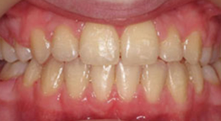patient-06-after.jpg